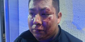 “No vamos a detener los operativos”: Ale Rojo de la Vega tras agresión en la Doctores